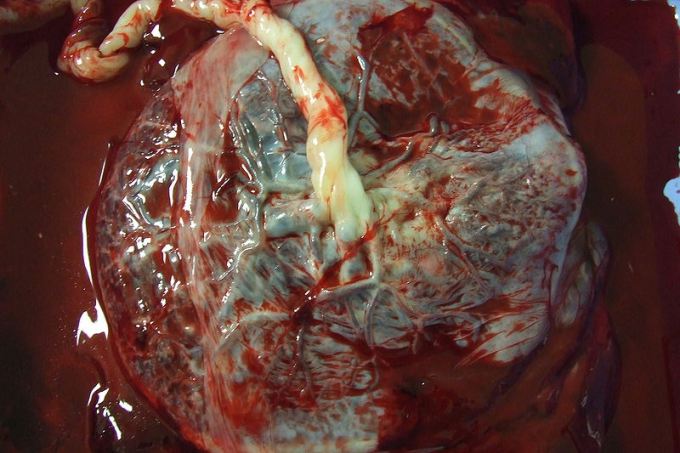 Placenta humana